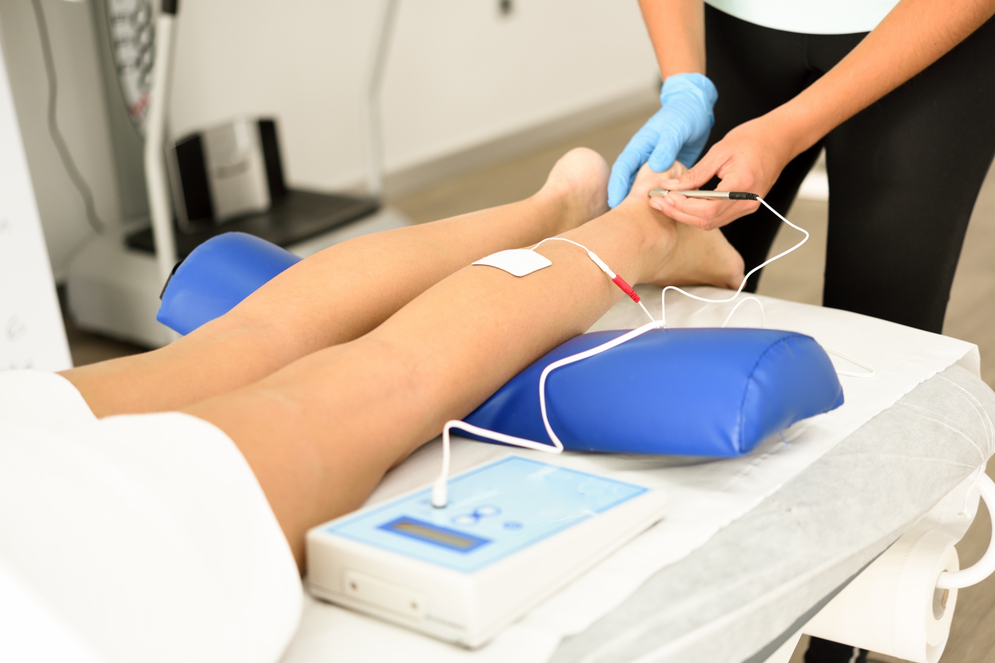electroacupuncture-dry-with-needle-female-ankle